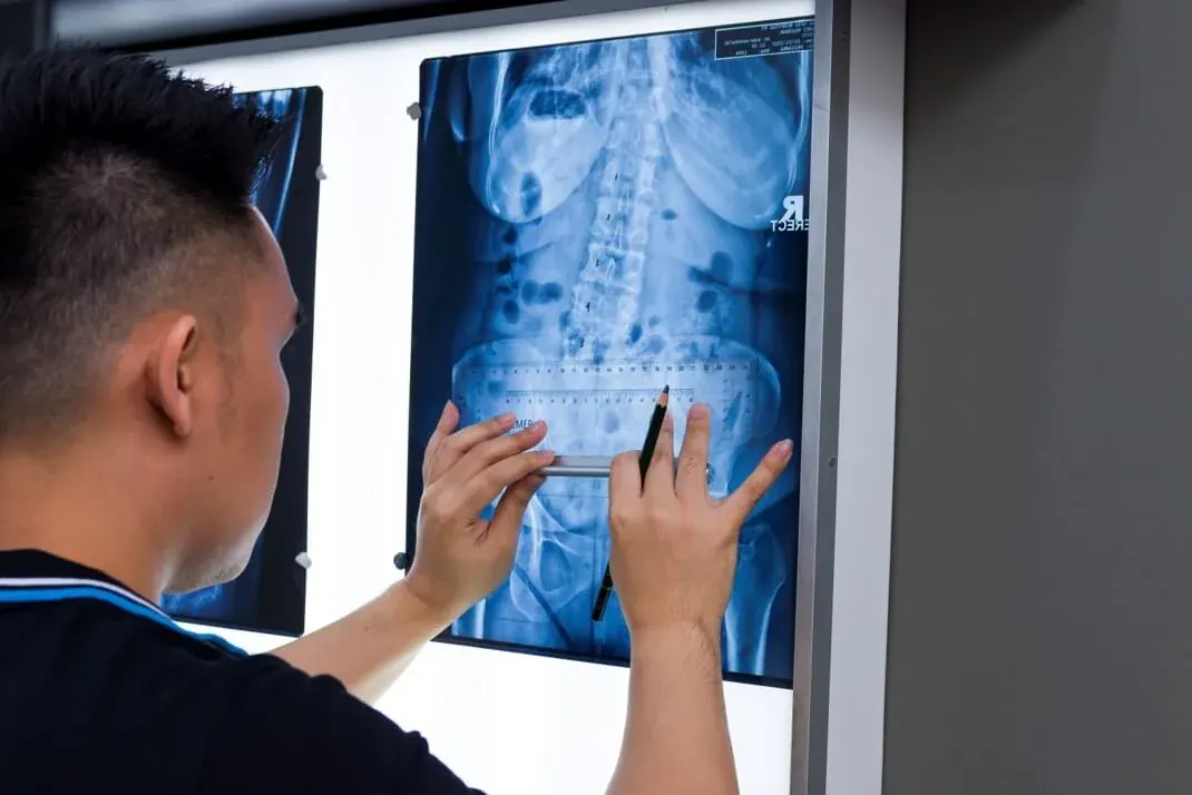 X-ray analysis · The 5-Point Spine Check